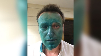 Навальный может лишиться зрения на один глаз после нападения с зелёнкой