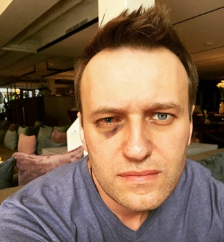 Алексею Навальному провели операцию на глазу