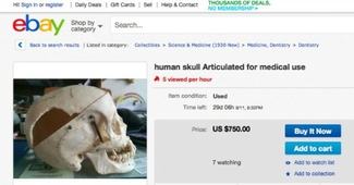 На интернет-аукционе eBay запретили продавать части человеческих тел